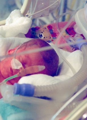 baby in NICU